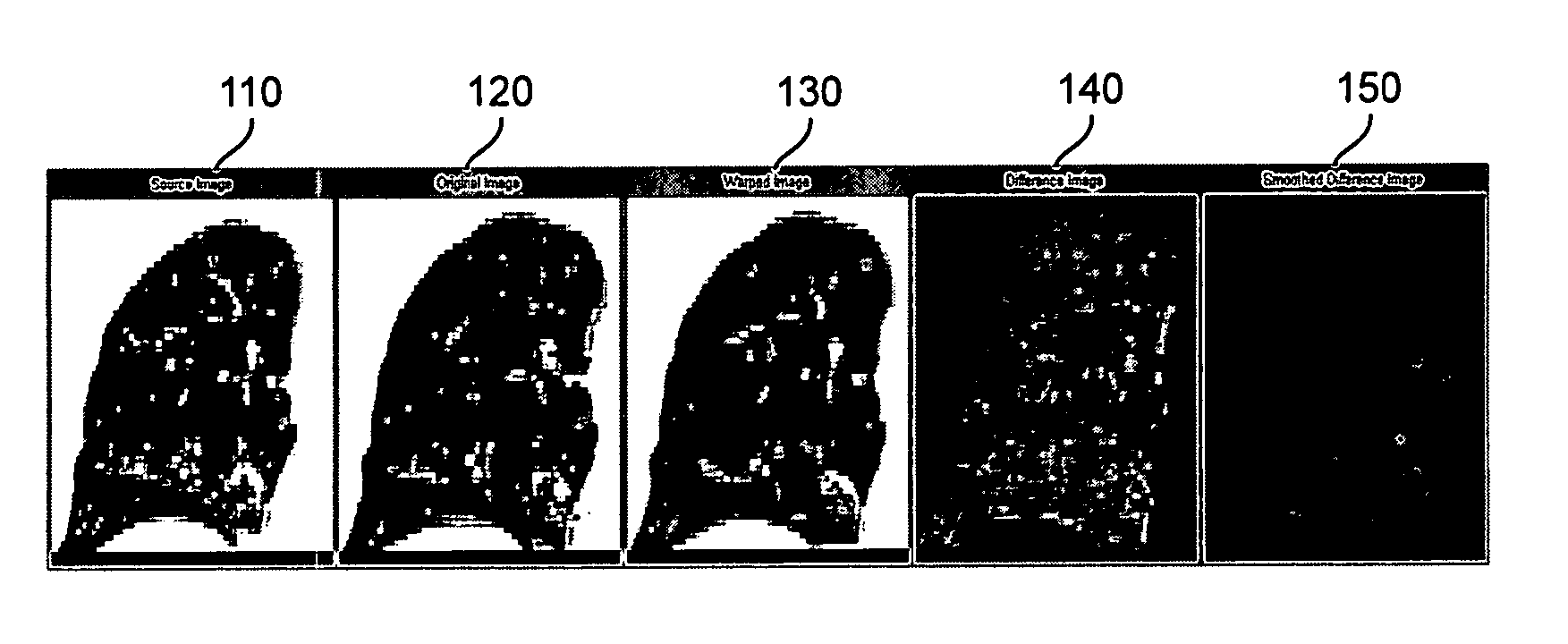 Method and system for using computed tomography to test pulmonary function