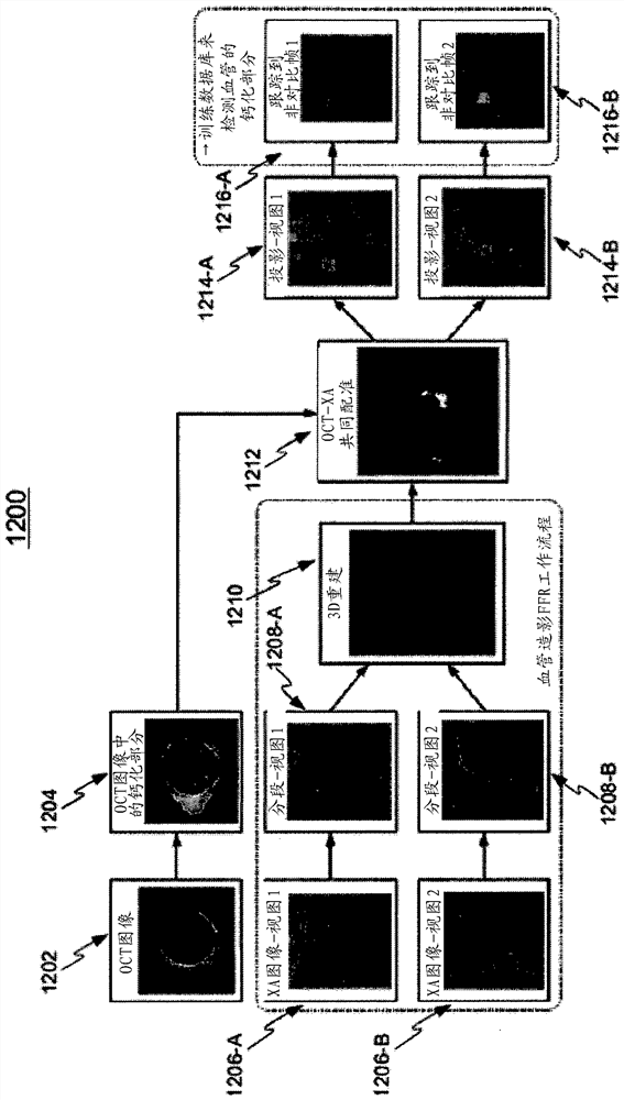 Assessment of coronary artery calcification in angiographic images