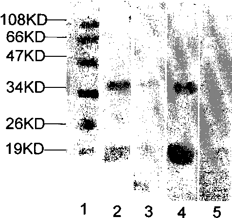 Method for cutting Yersinia pestis F1 antigen and relative application thereof