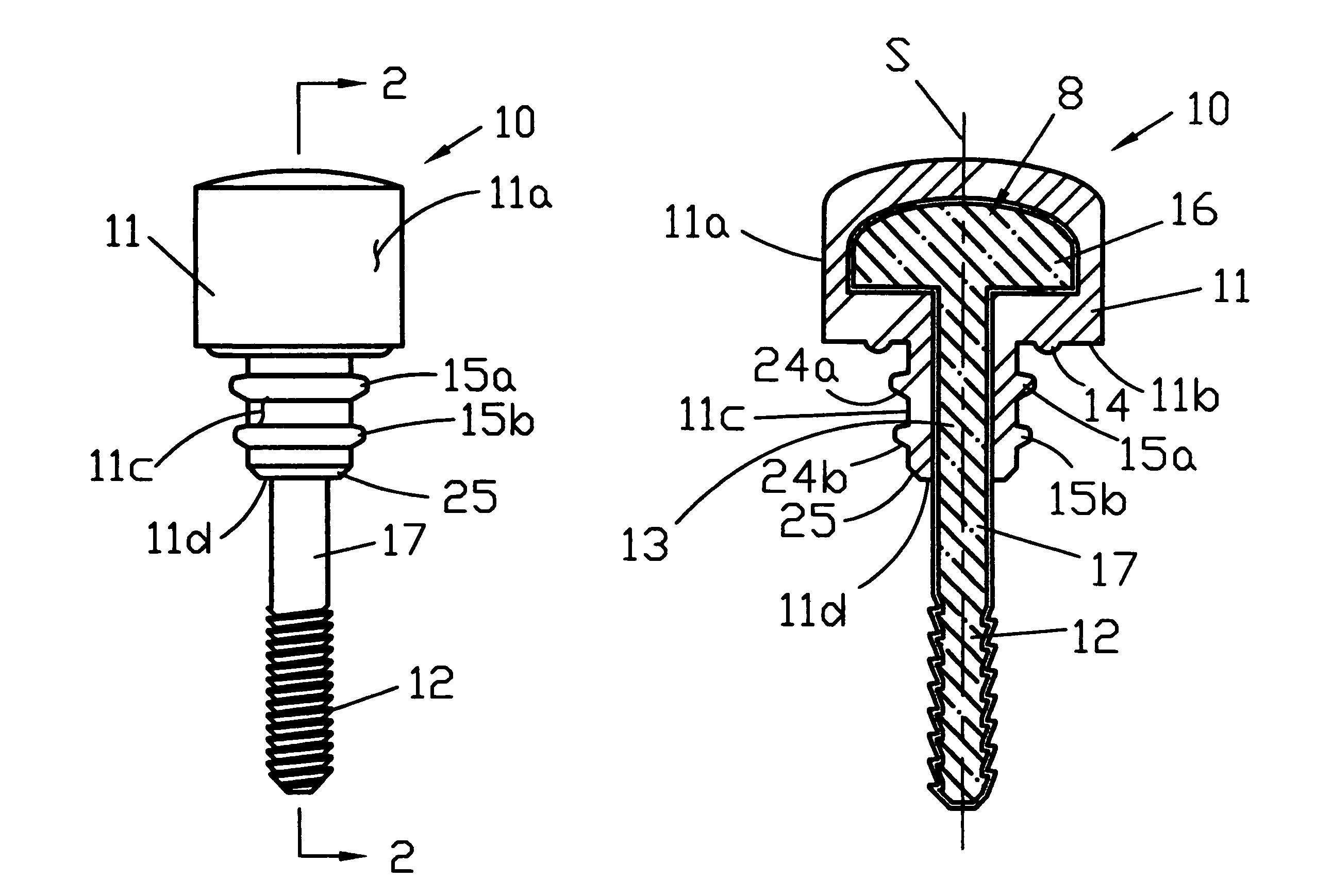 Integrated fastener and sealing system for plumbing fixtures