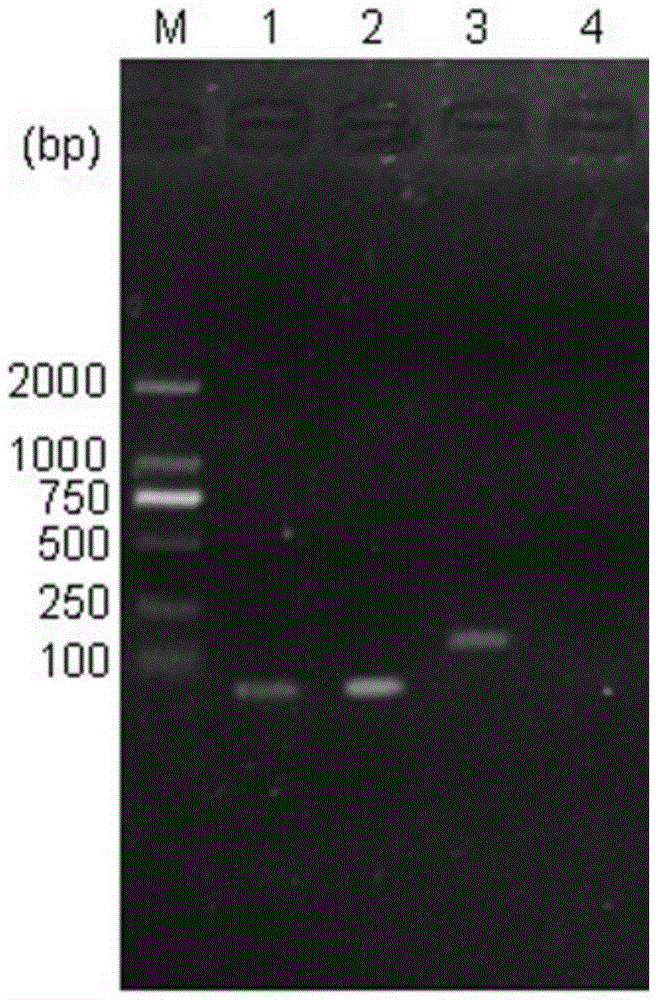 Multiple PCR primer set and probes and detecting method for simultaneously detecting three kinds of aeromonas