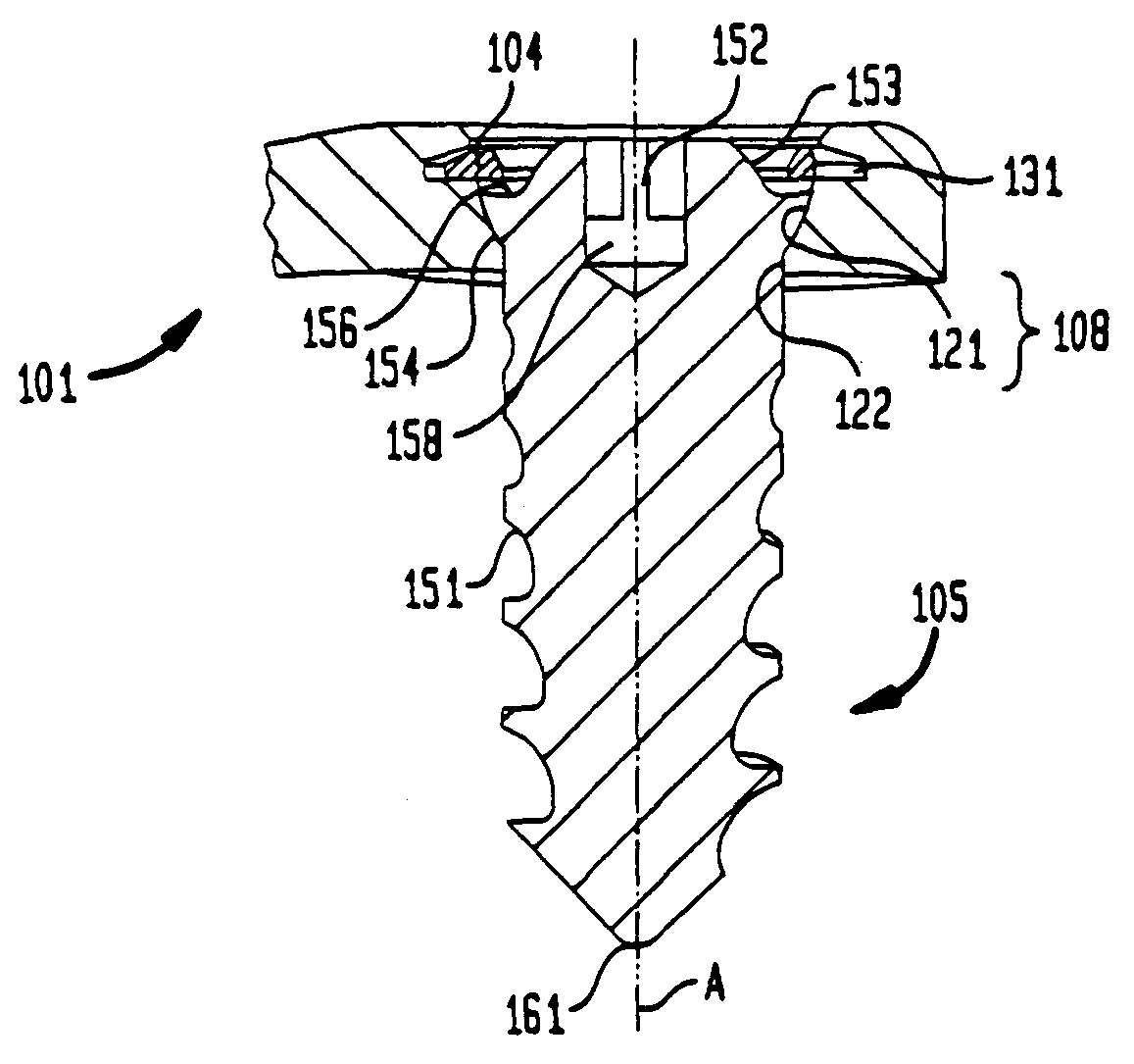 Bone screw retaining system