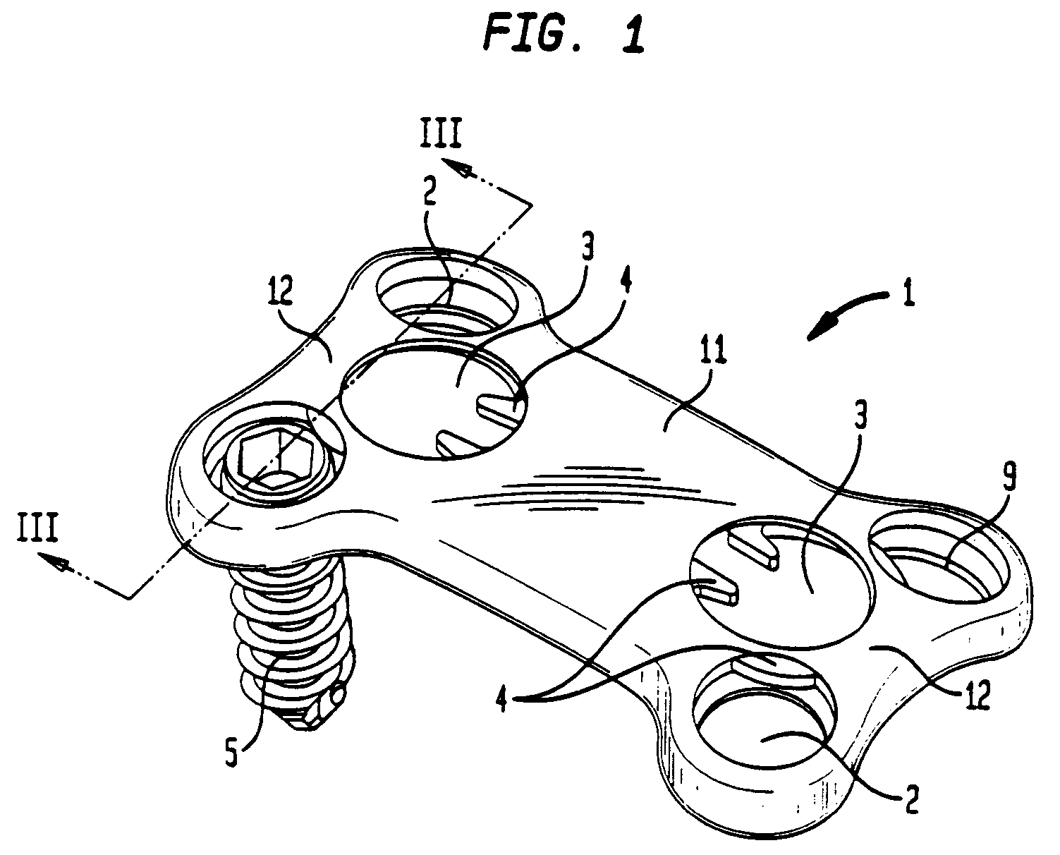 Bone screw retaining system