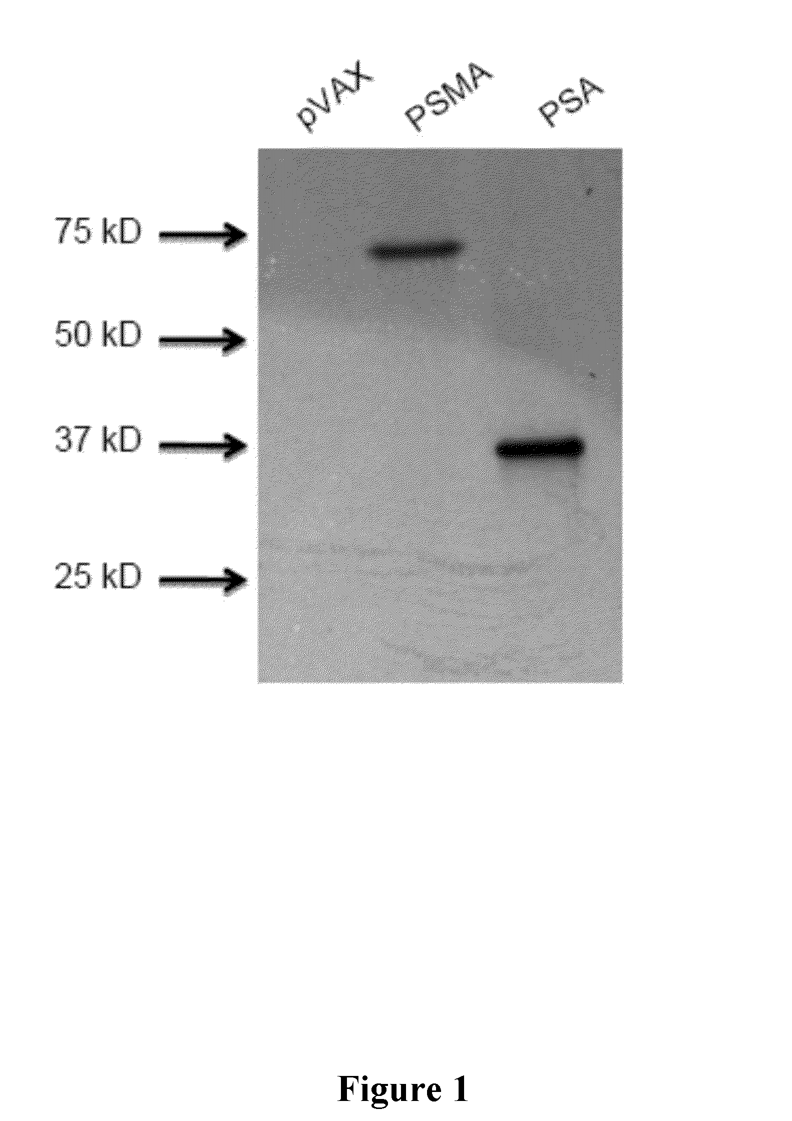 Consensus Prostate Antigens, Nucleic Acid Molecule Encoding The Same And Vaccine And Uses Comprising The Same