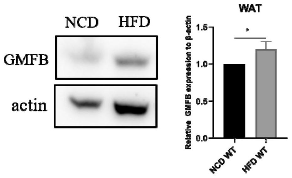 Application of GMFB as insulin resistance biomarker