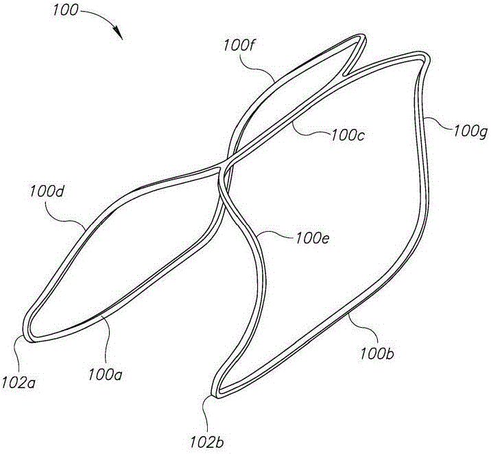 A dilating device for the prostatic urethra