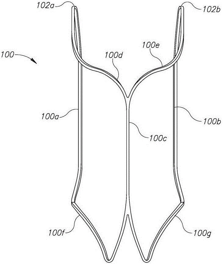 A dilating device for the prostatic urethra