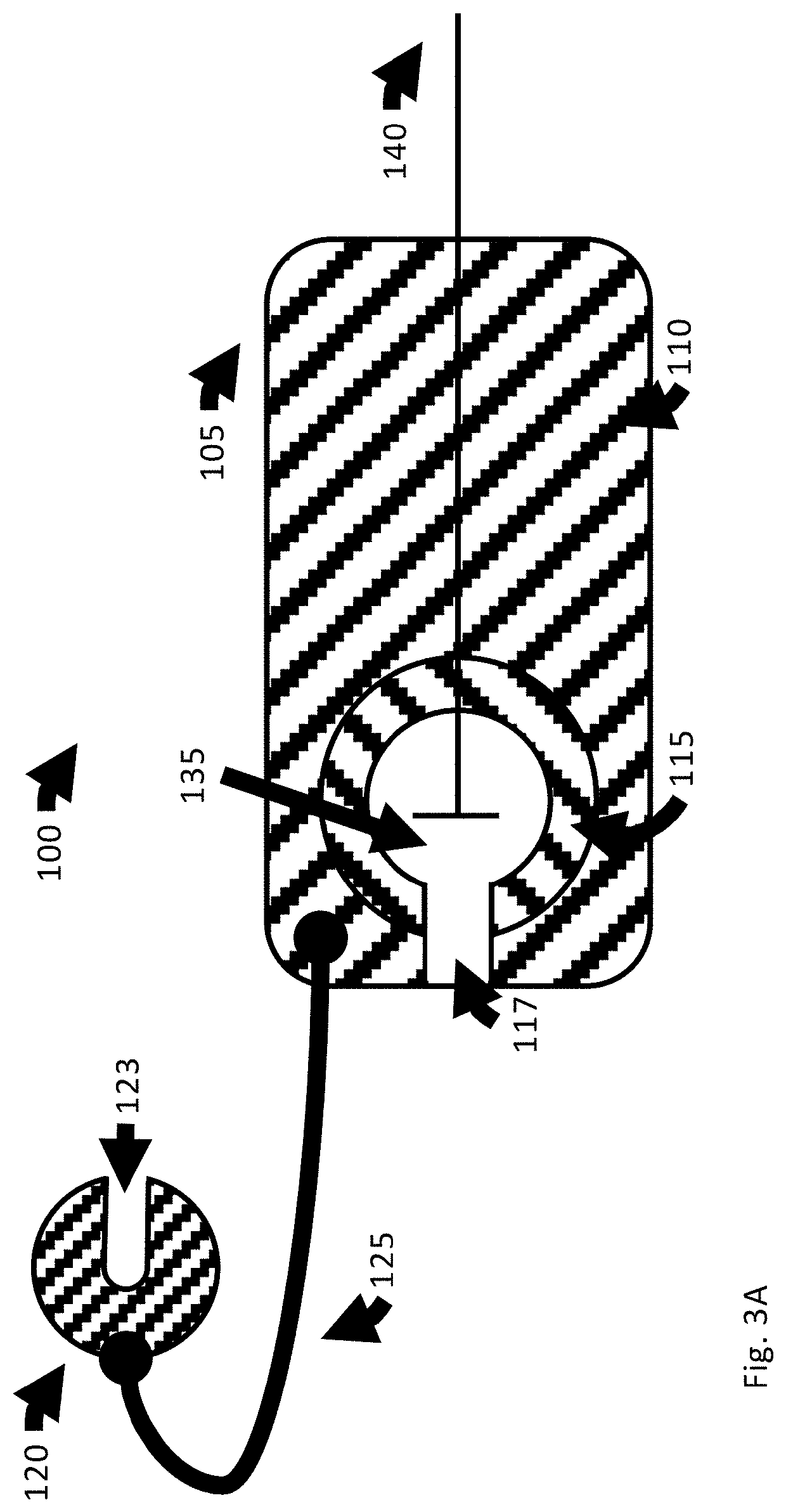 Catheter anchor system and method thereof