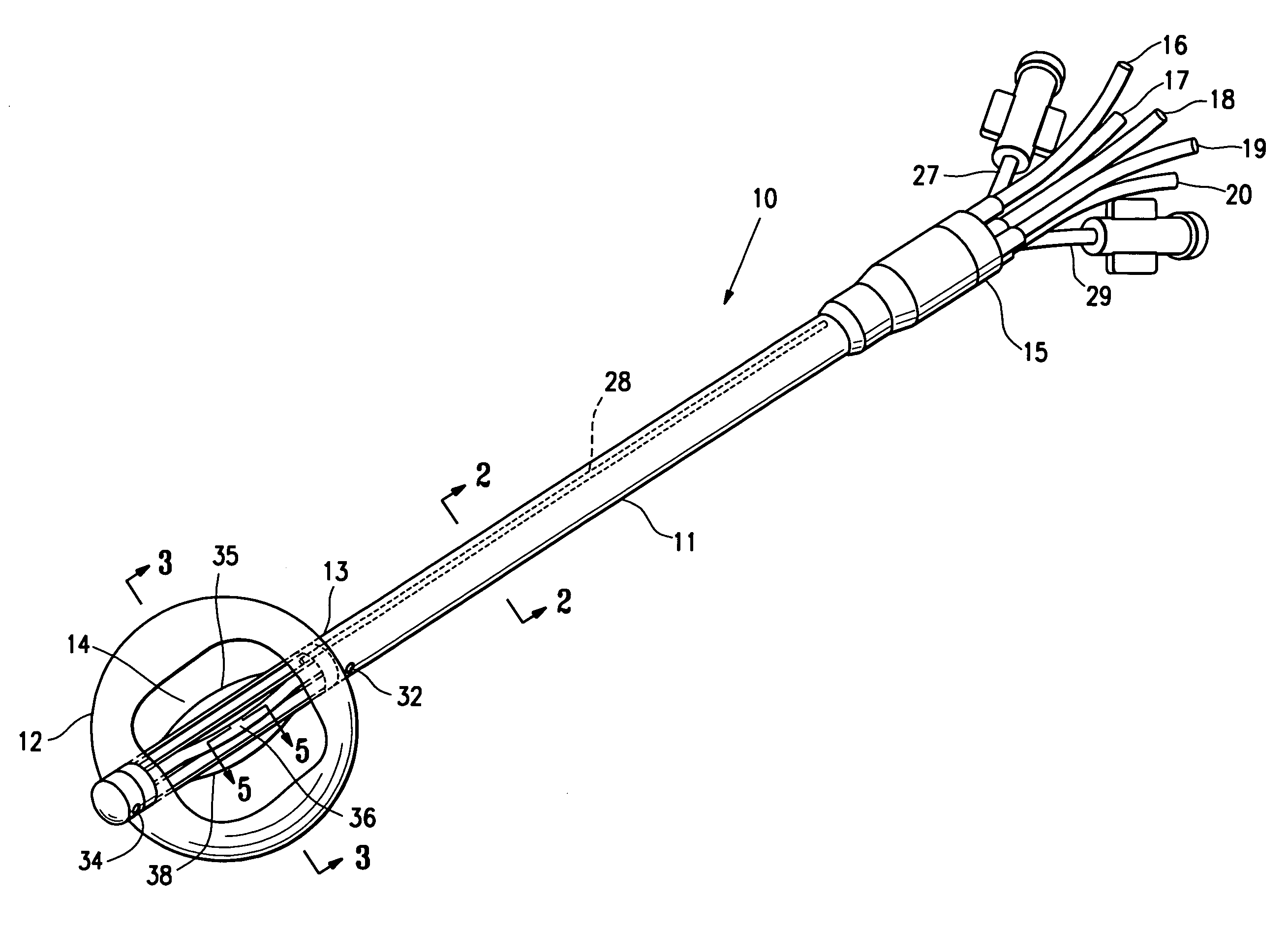 Soft body catheter with low friction lumen