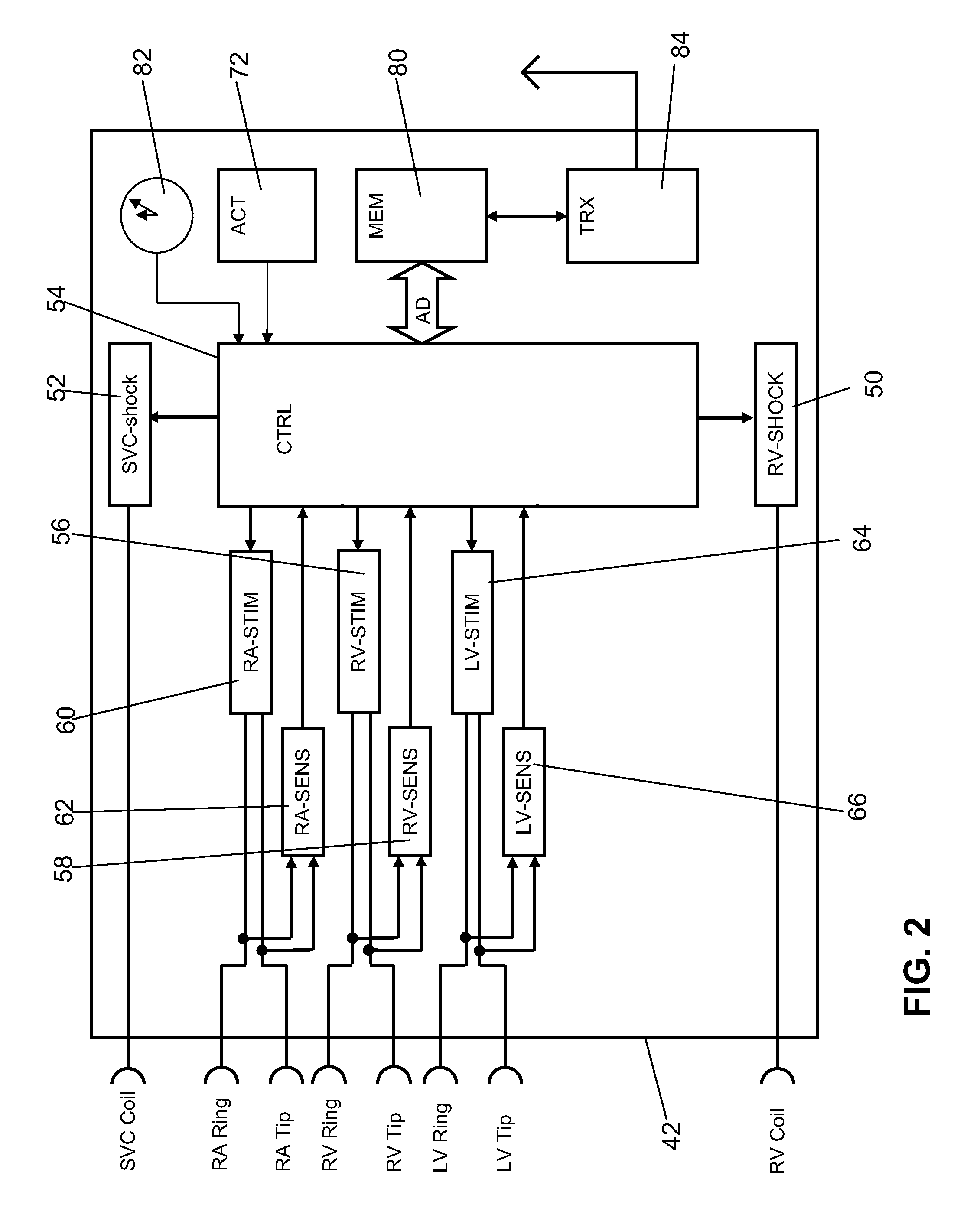 Antitachycardiac stimulator