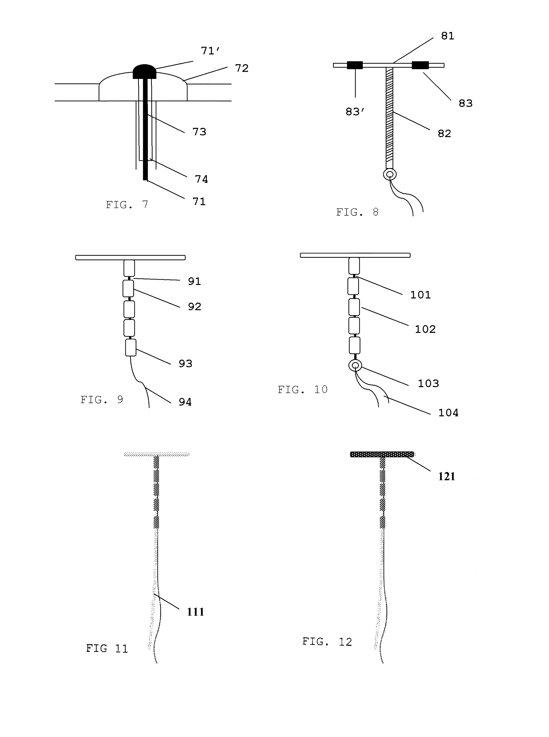 Copper-releasing hybrid iud with adaptable retention arm connected to frameless body