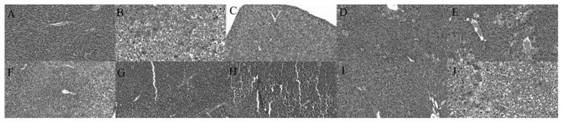 Construction of long-circulating liposome of fraxetin and its research on anti-enteritis effect