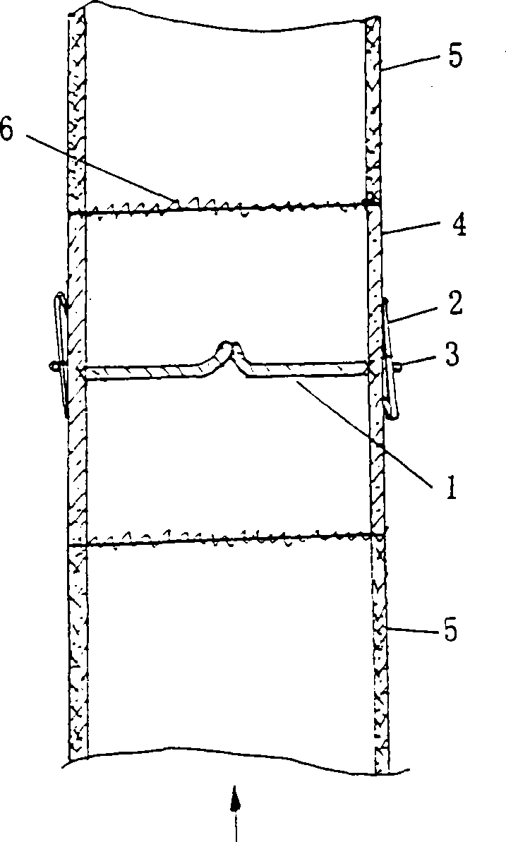 Support type artificial venous blood vessel with valve