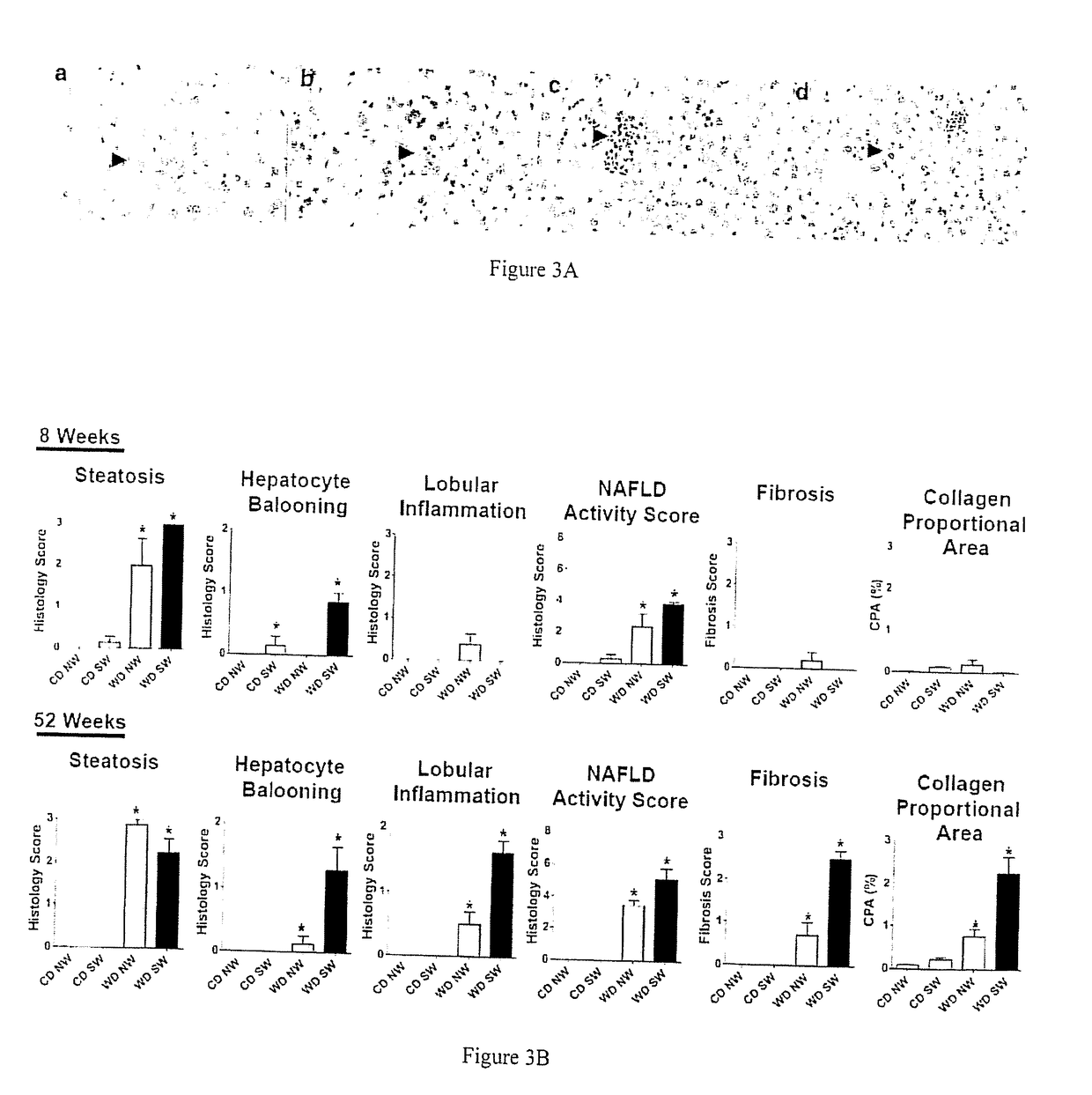 A mouse model of nonalcoholic steatohepatitis and uses thereof