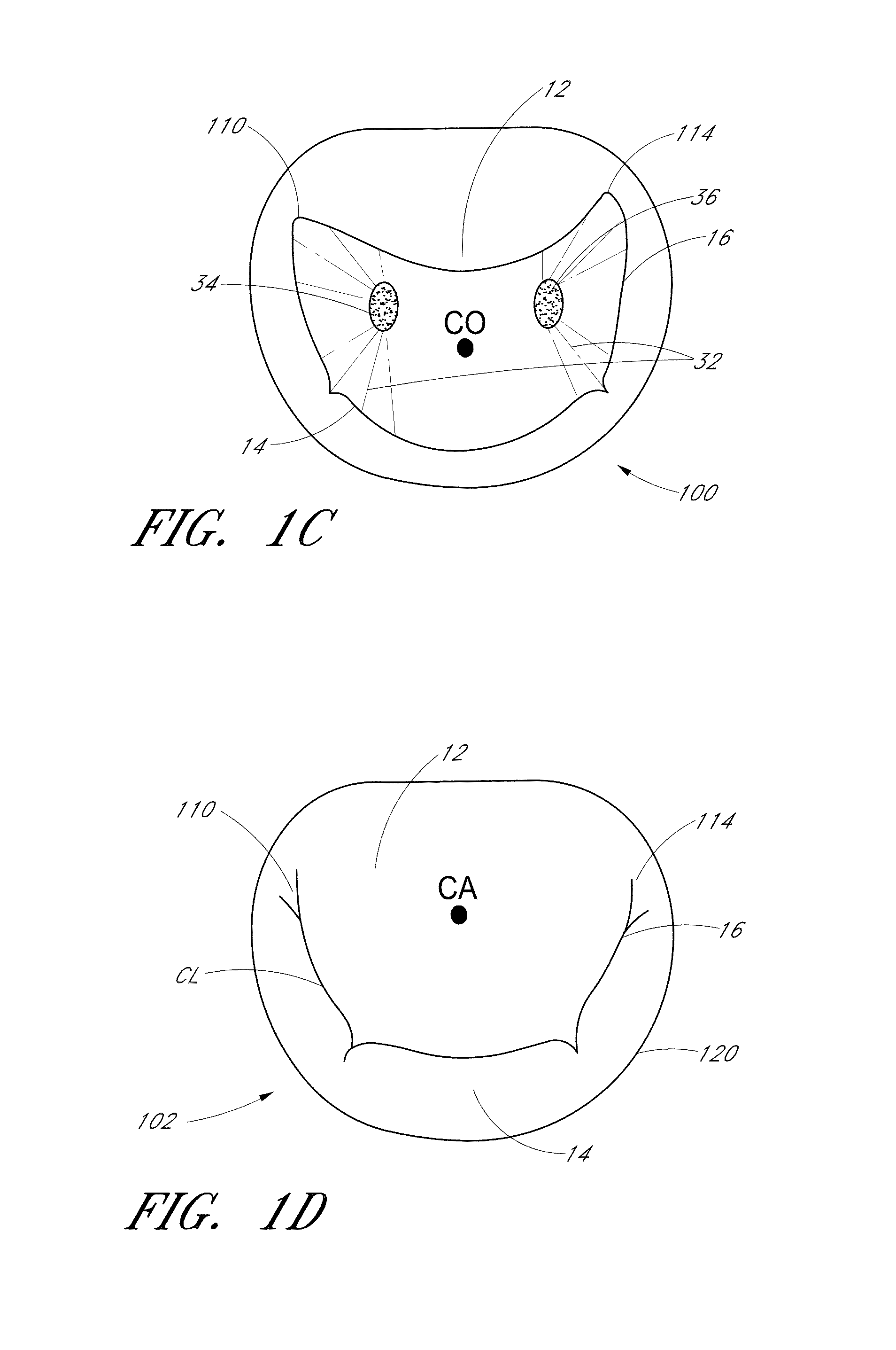 Device, system, and method for transcatheter treatment of valve regurgitation