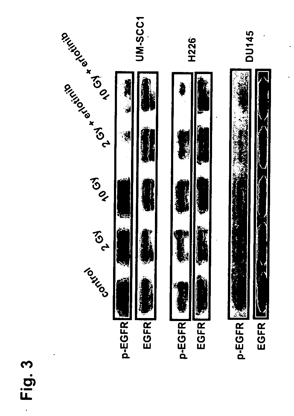 Combined treatment with radiation and an epidermal growth factor receptor kinase inhibitor