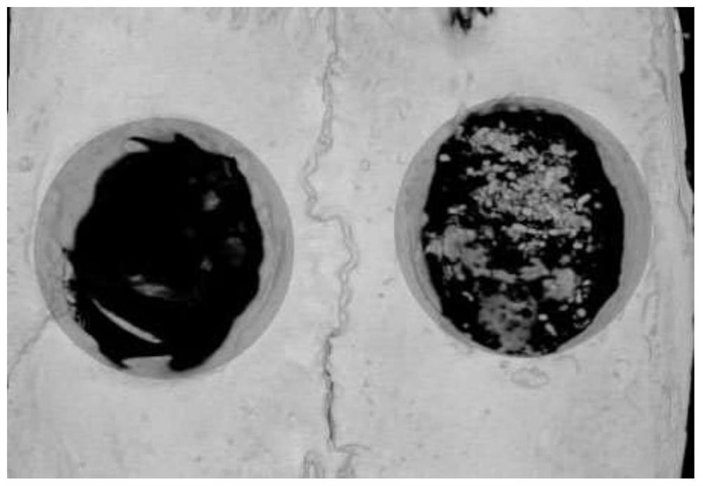 Antibacterial osteogenesis-promoting absorbable bone wax and preparation method thereof