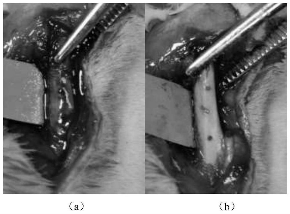 Antibacterial osteogenesis-promoting absorbable bone wax and preparation method thereof