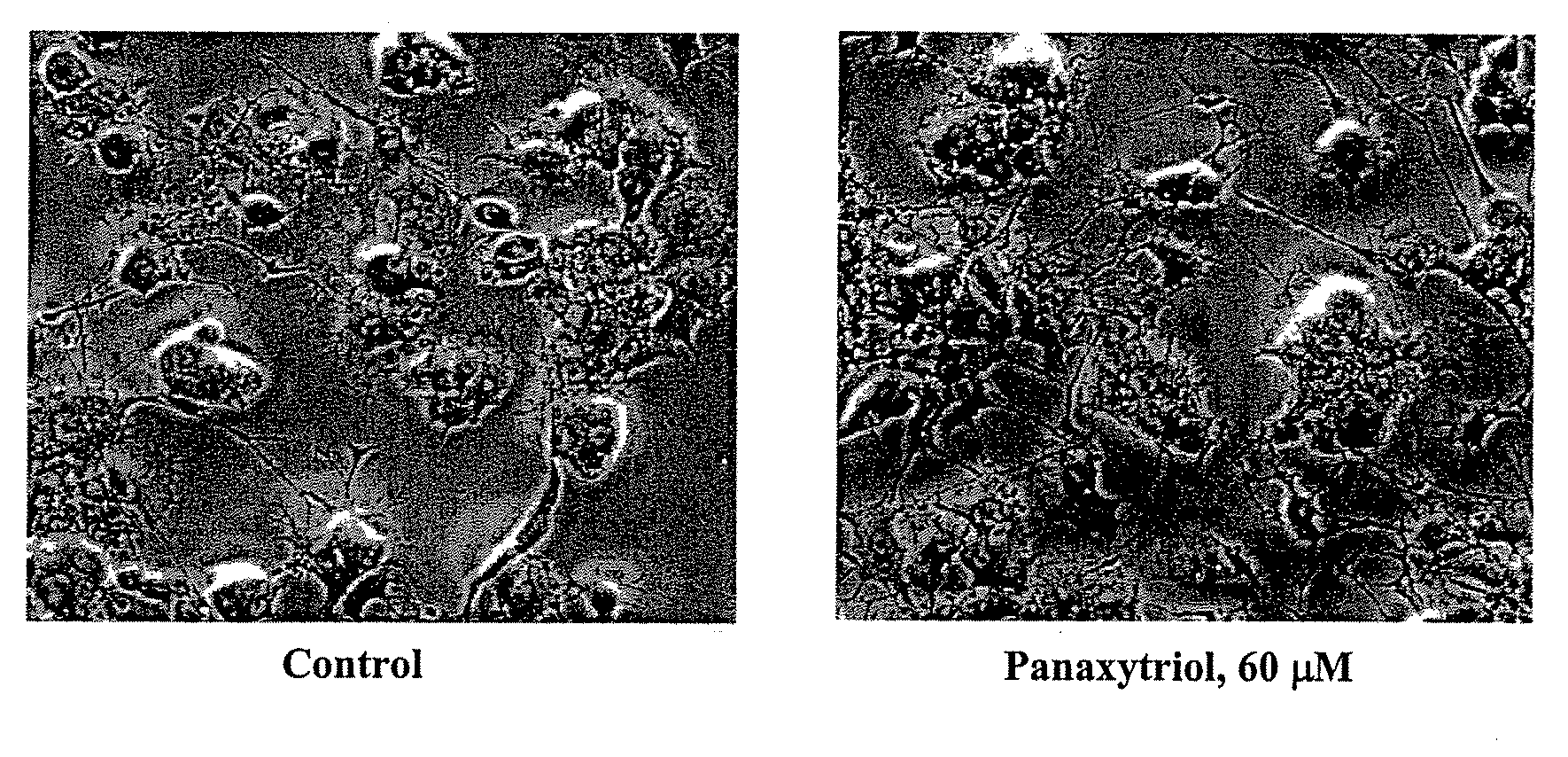 Compositions and methods  for treating cancer or a neurotrophic disorder