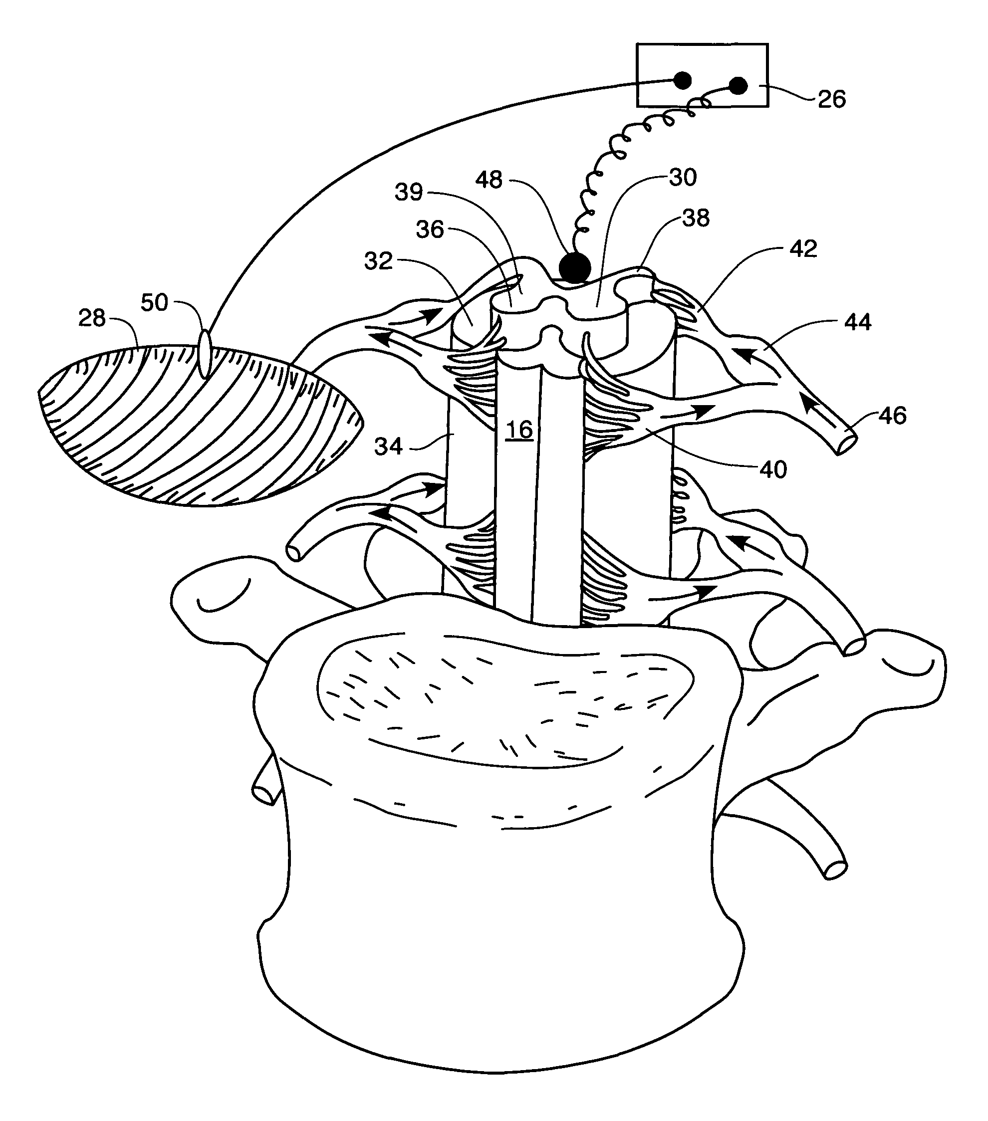 Method and apparatus for improving renal function