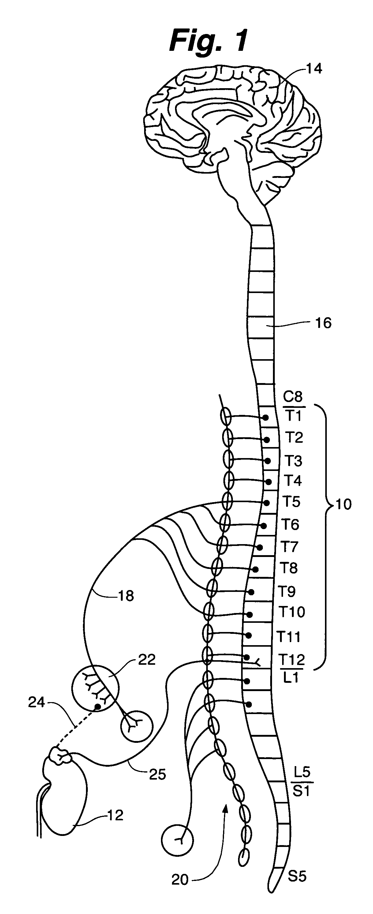 Method and apparatus for improving renal function