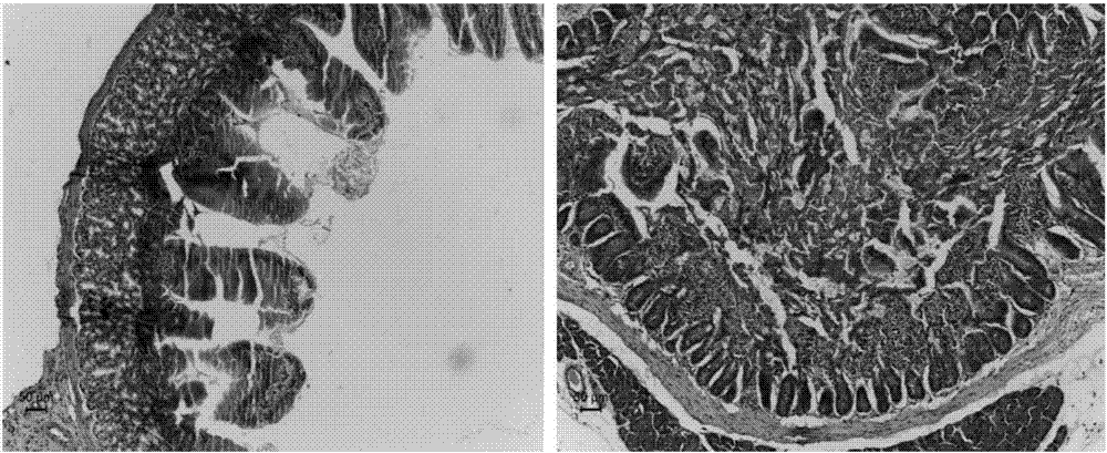 Method for building mouse acute radiation duodenitis model