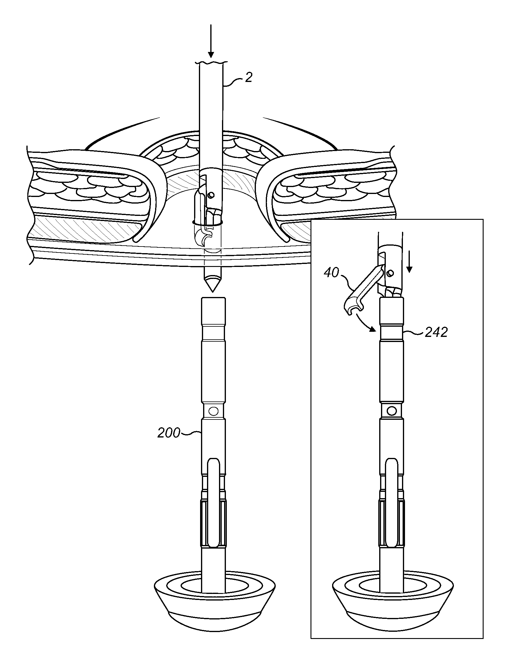 Forceps comprising a trocar tip