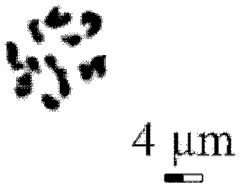 Tabletting method of plum blossom shoot tip chromosome