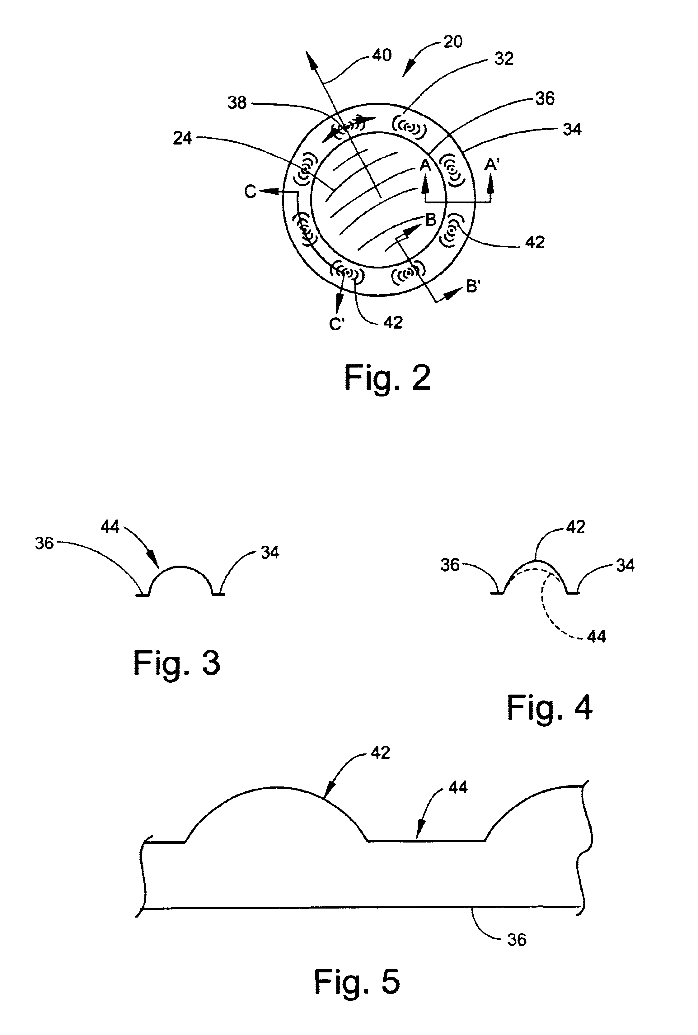 Tangential stress reduction system in a loudspeaker suspension