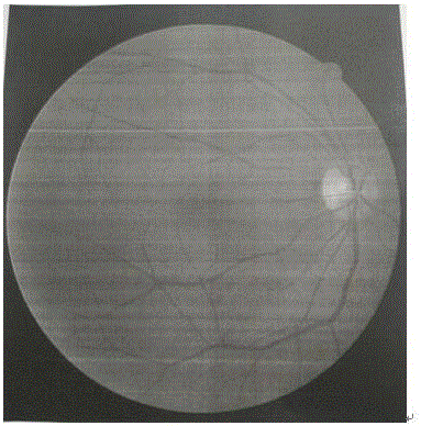 End-to-end image segmentation processing method and system