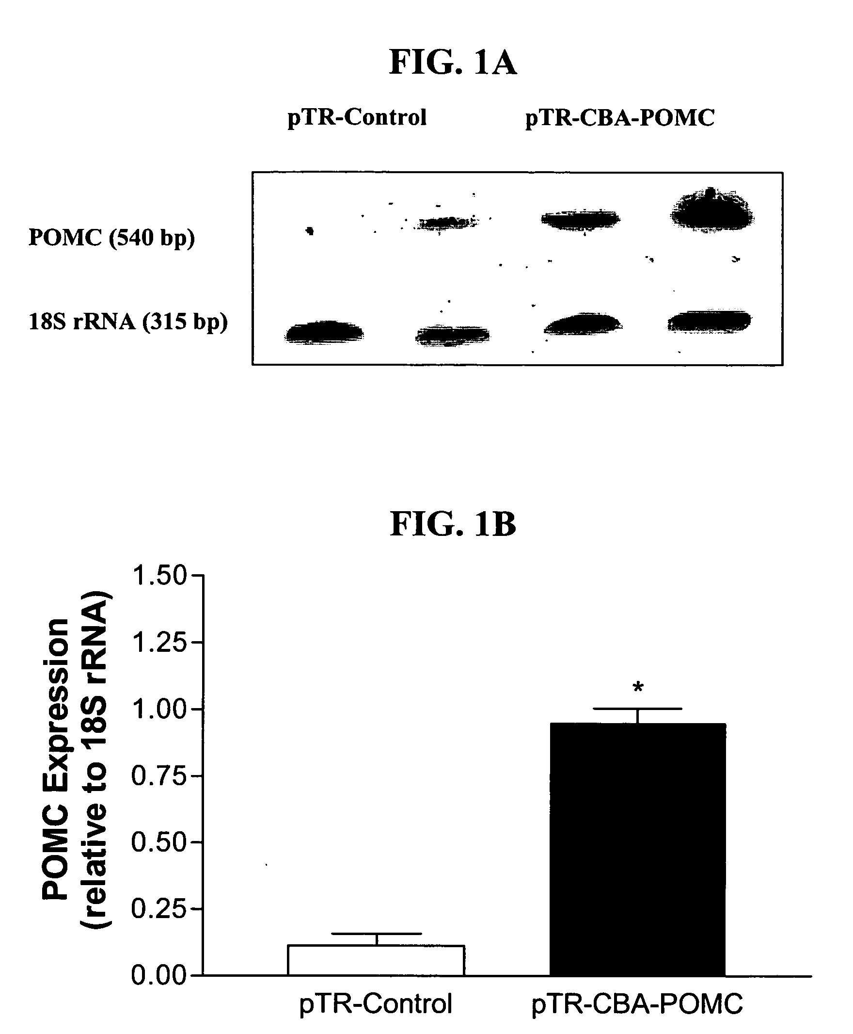 RAAV vector-based pro-opiomelanocortin compositions and methods of use