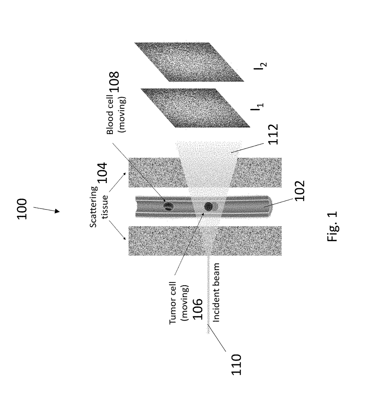 Noninvasive, label-free, in vivo flow cytometry using speckle correlation technique