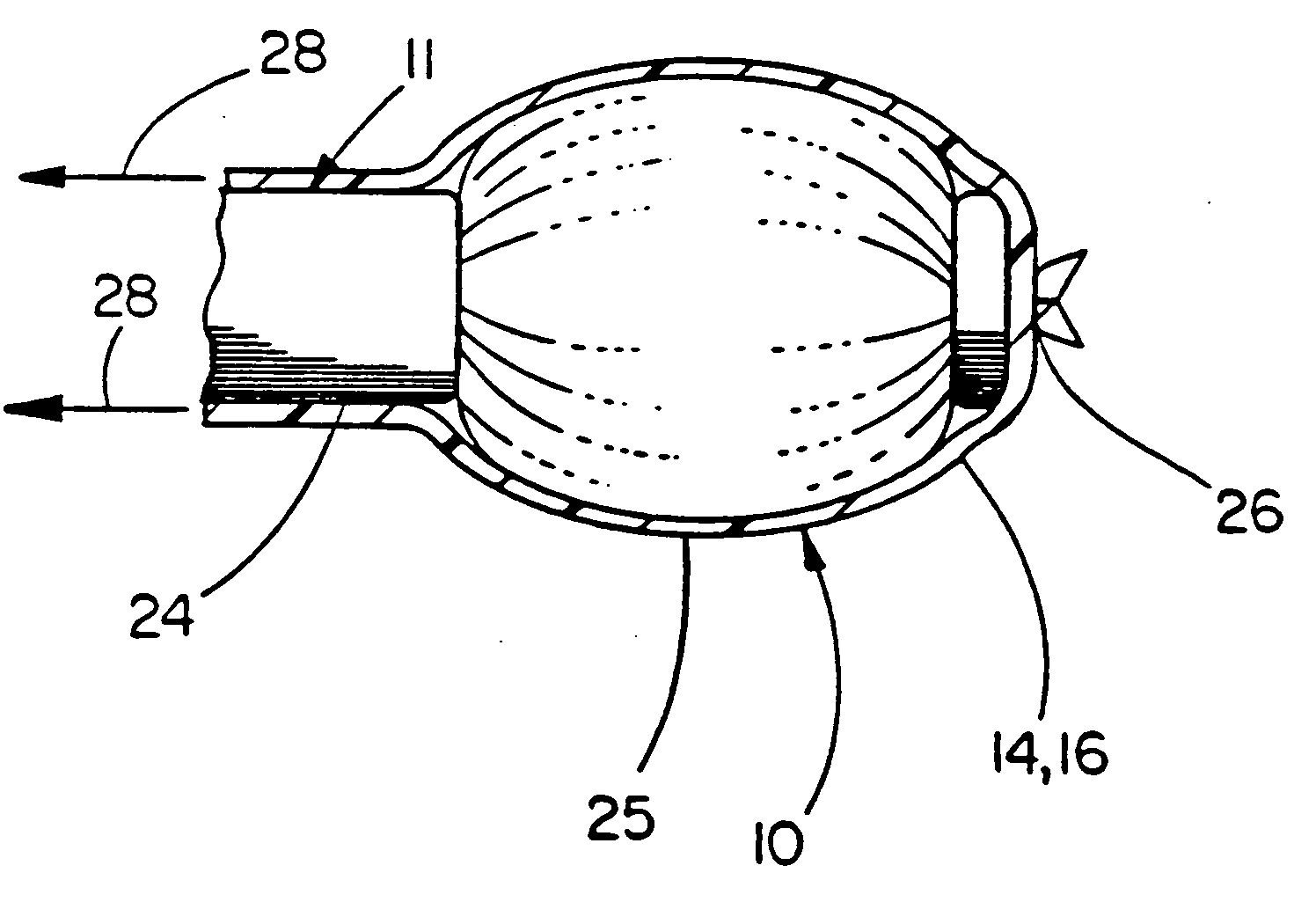 Balloon catheter device