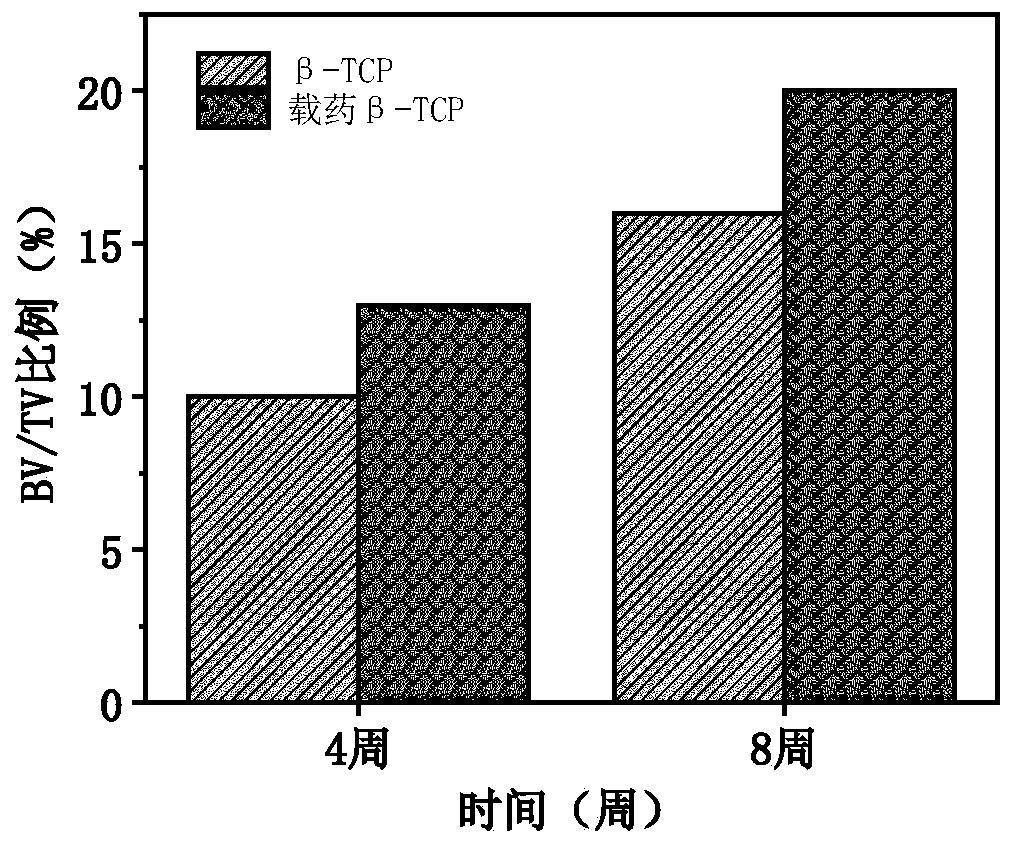 Beta-tricalcium phosphate porous ceramic drug-loading stent and preparation method and application thereof