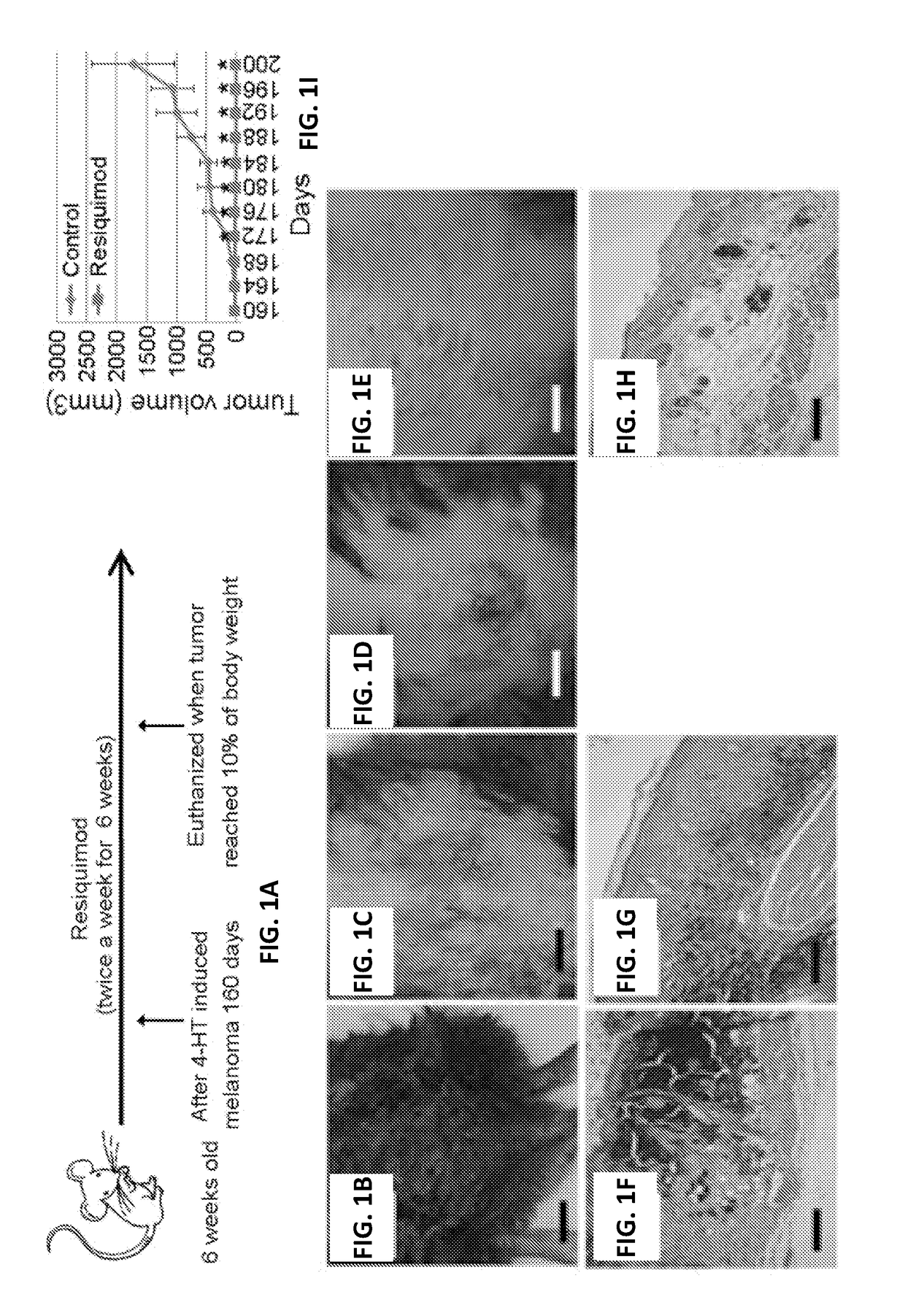 Resiquimod topical and injectable compositions for the treatment of neoplastic skin conditions