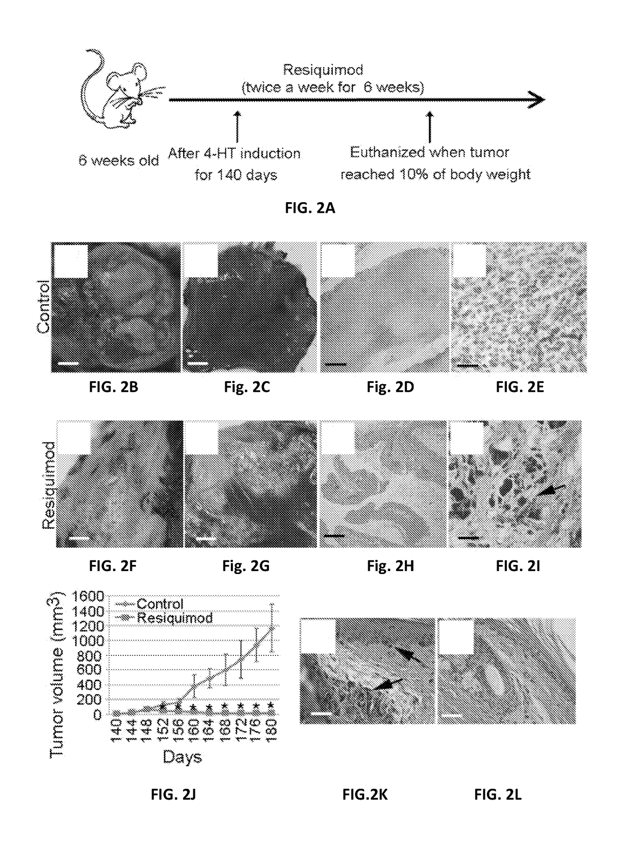 Resiquimod topical and injectable compositions for the treatment of neoplastic skin conditions