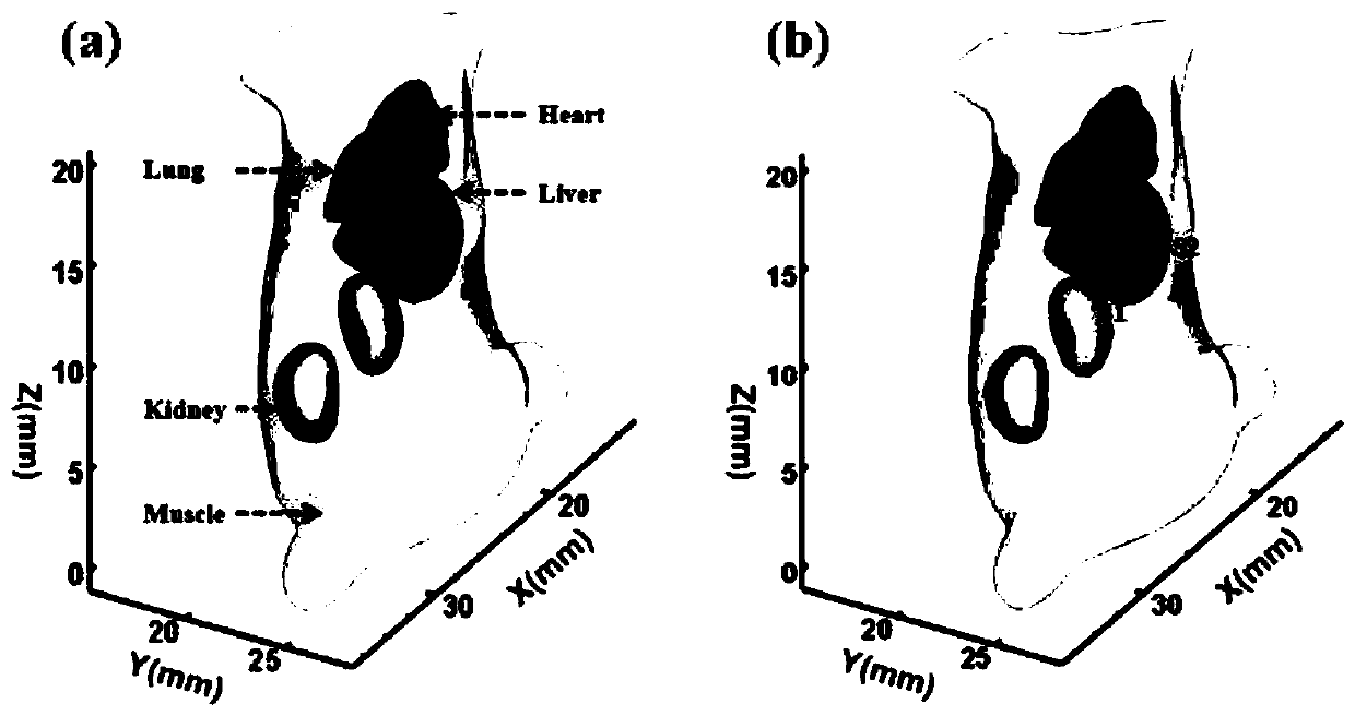 Elastic network excitation fluorescence tomography reconstruction system based on adaptive parameter search