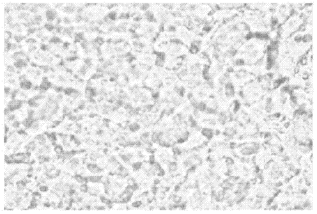 Method for culturing human limbal stem cell graft