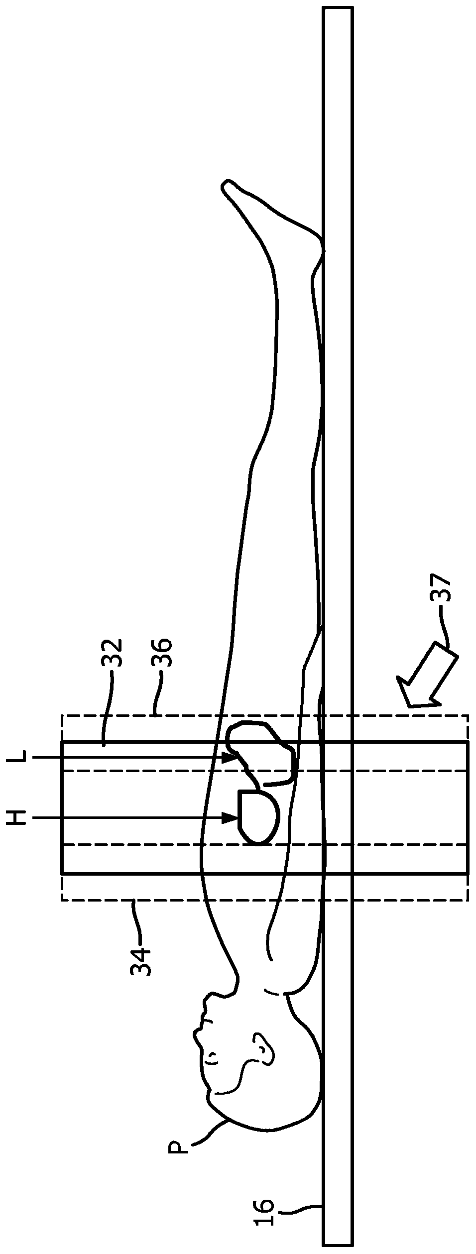 Short leading and trailing frames to improve image quality in positron emission tomography (PET)