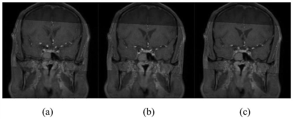 Intracranial blood vessel image fusion method and computer readable storage medium