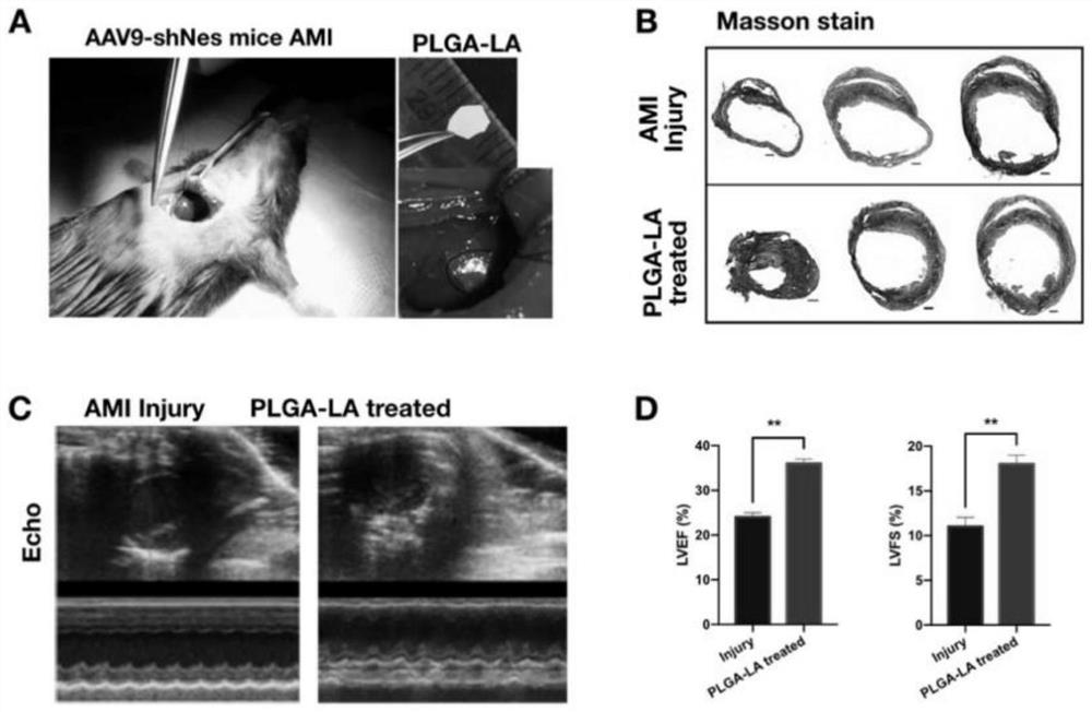 Preparation of lipoic acid-loaded nano material and application of lipoic acid-loaded nano material in acute myocardial infarction disease