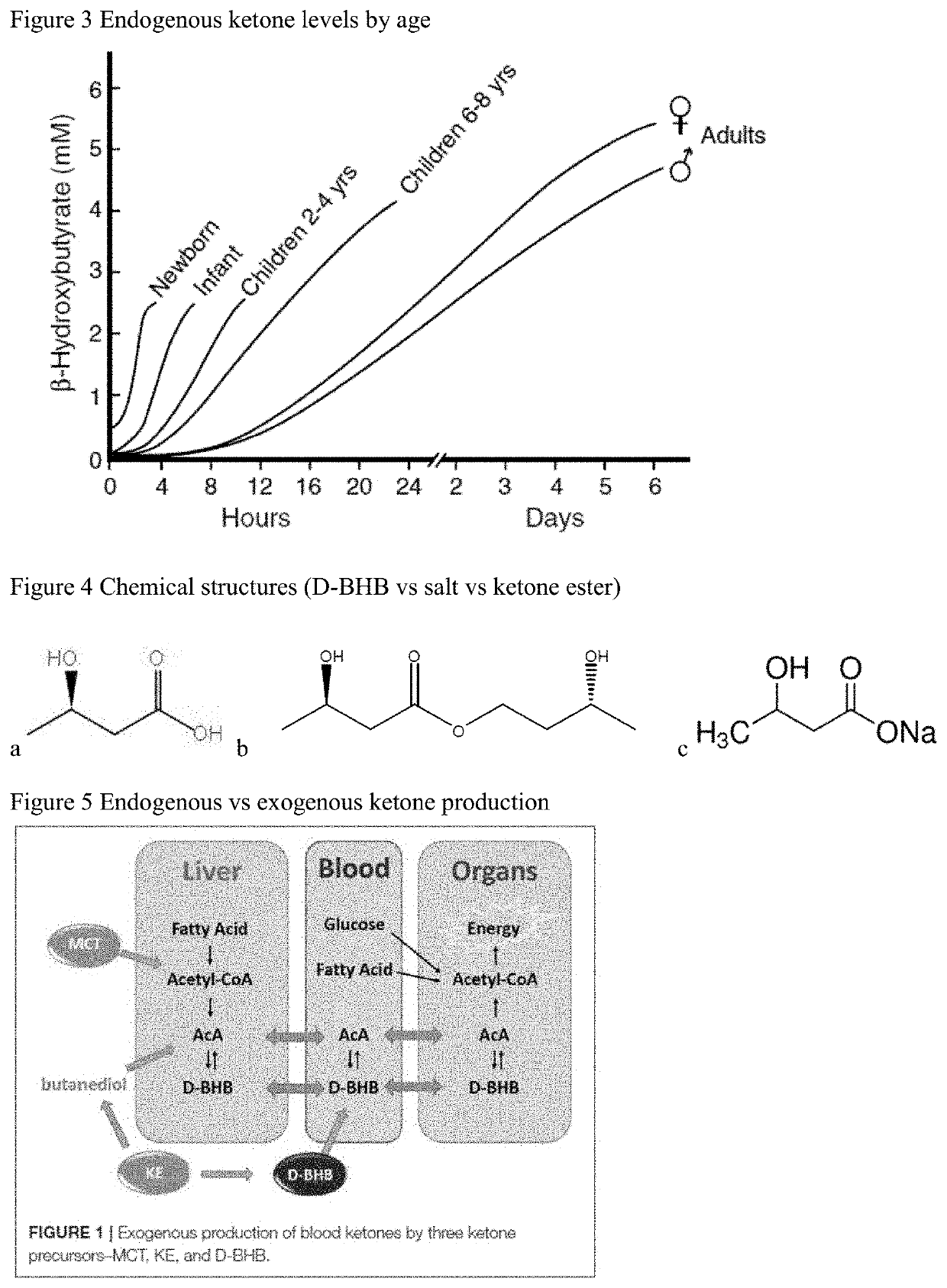 Exogenous ketone supplementation compositions, systems and methods