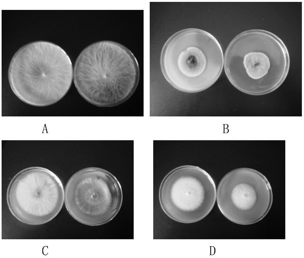 Method for preparing antibacterial biological pesticide by using psidium guajava linn leaf extract