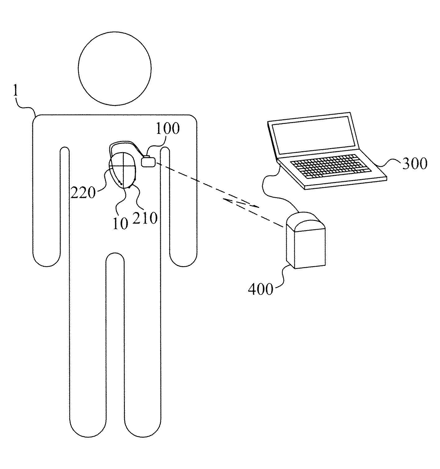 Identification of pacing site