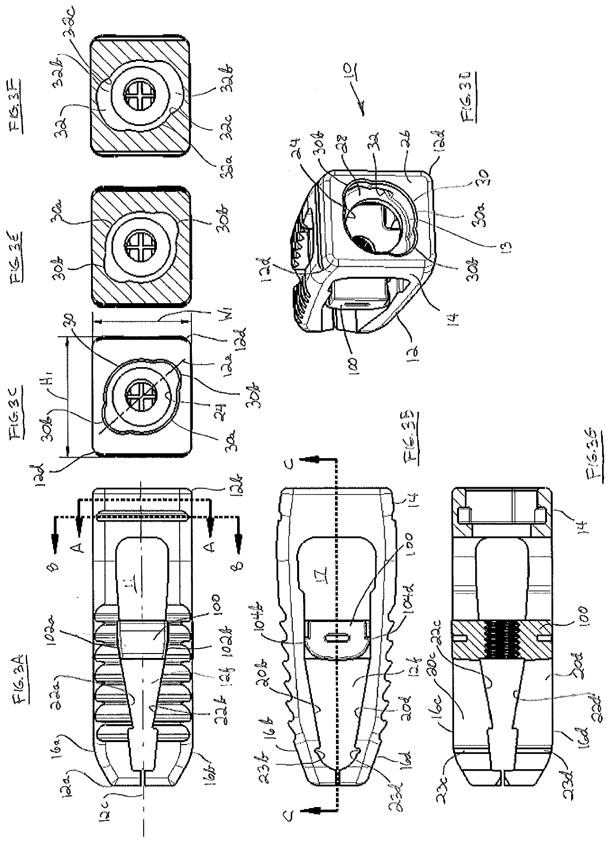 Expandable tlif device and related insertion and grafting instrumentation