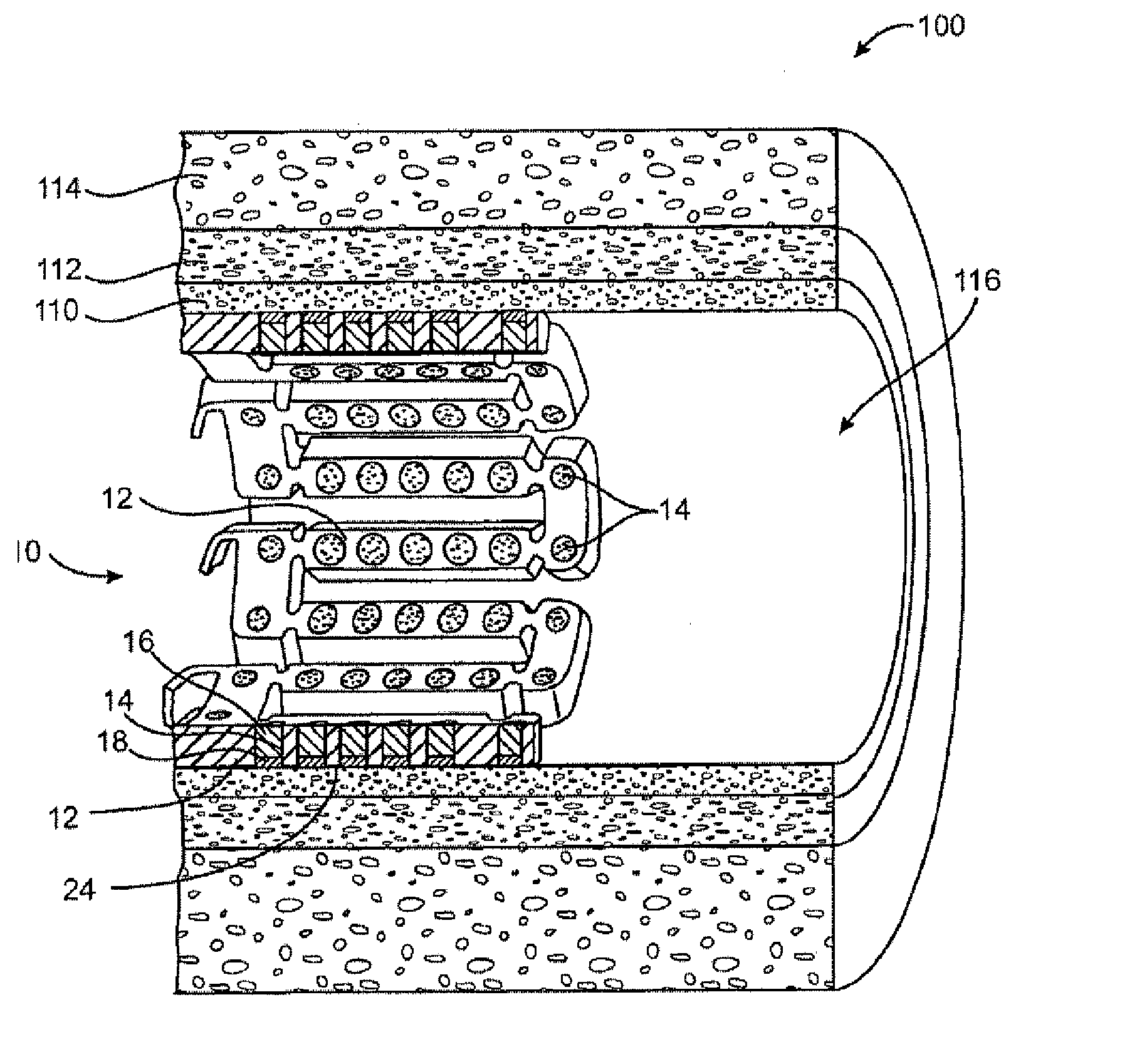 Methods and Devices for Reducing Tissue Damage After Ischemic Injury