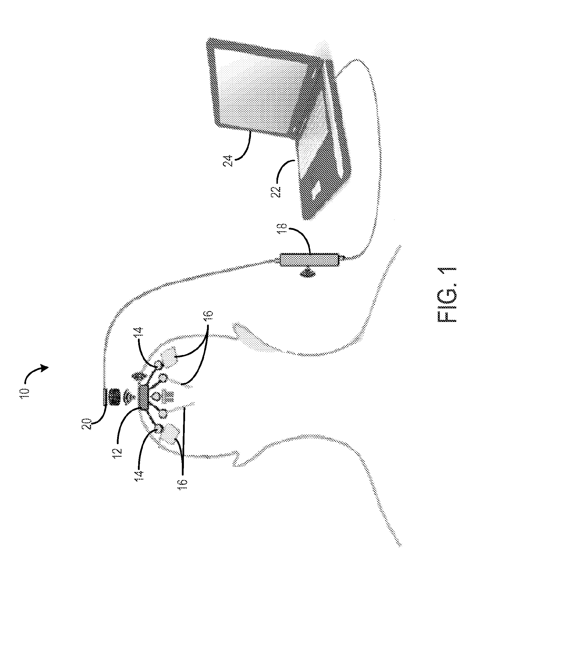 Method for cross-diagnostic identification and treatment of neurologic features underpinning mental and emotional disorders