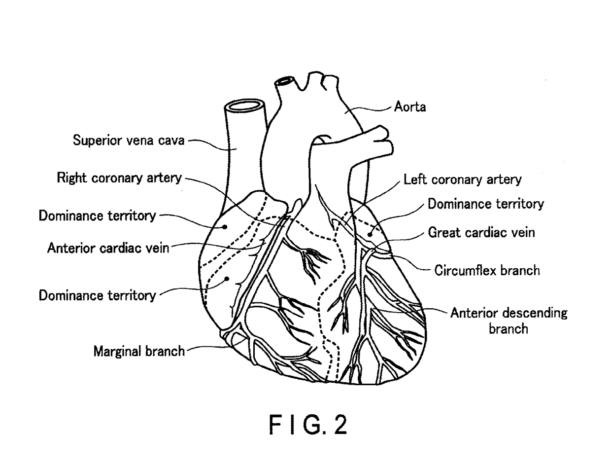 Medical image processing apparatus and medical image processing method