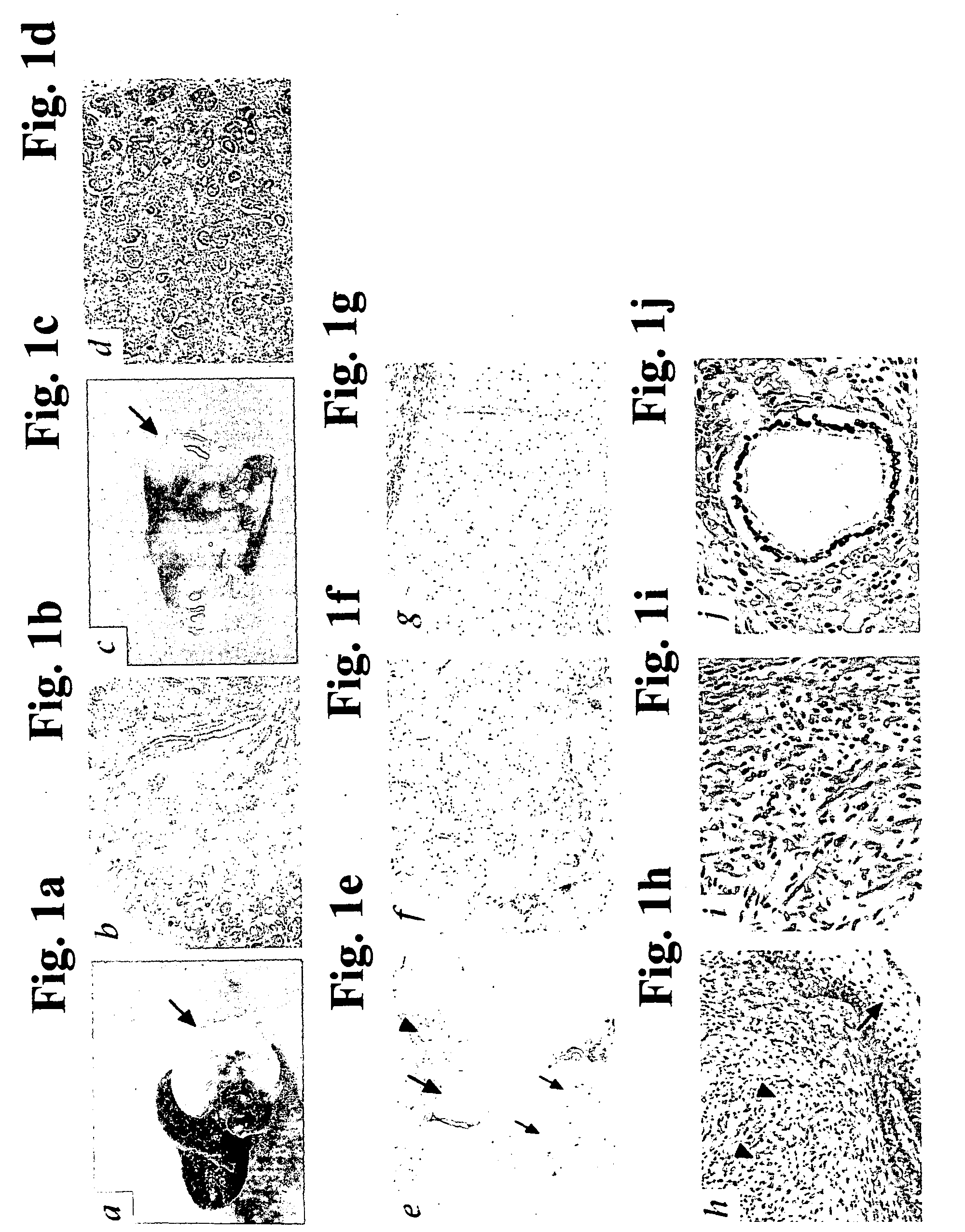 Methods of treating disease by transplantation of developing allogeneic or xenogeneic organs or tissues