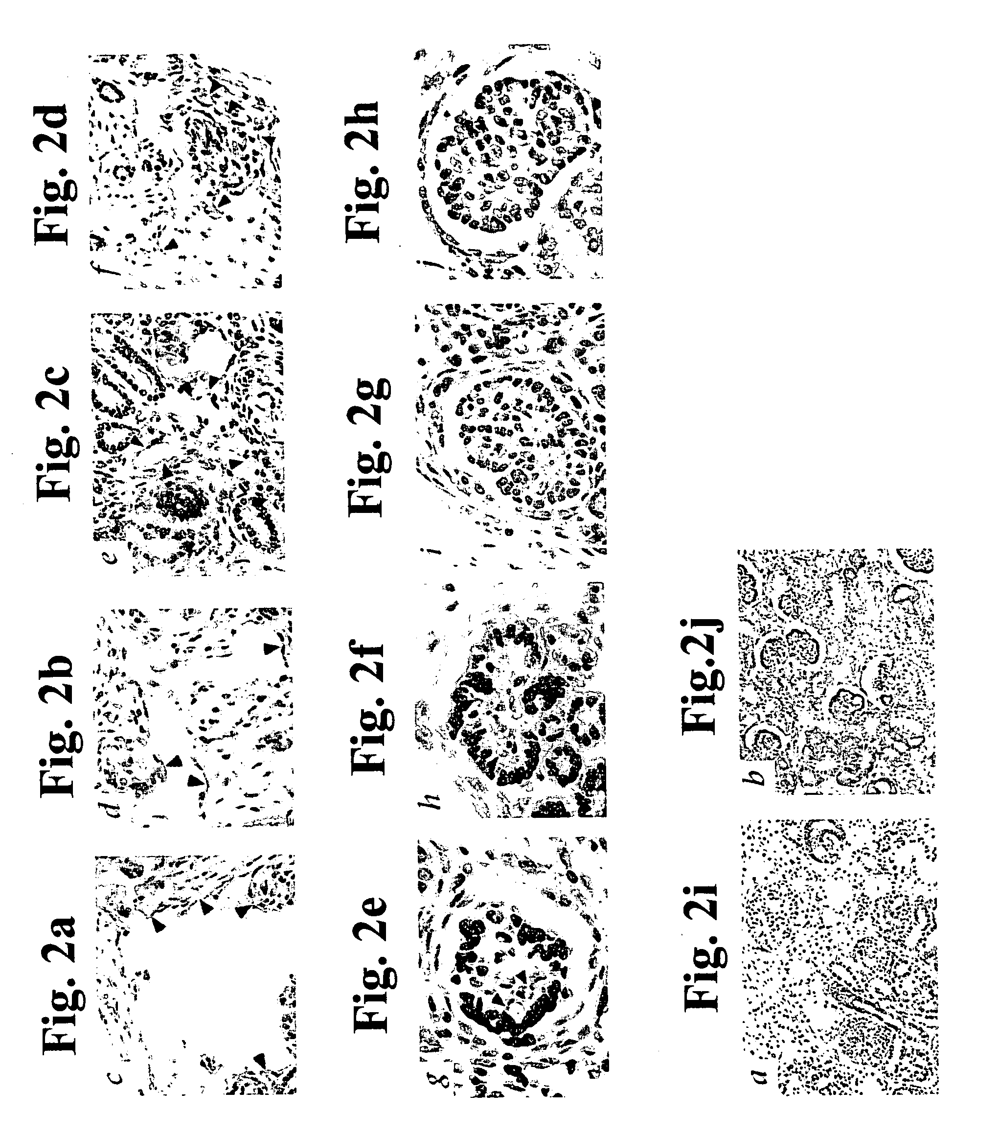 Methods of treating disease by transplantation of developing allogeneic or xenogeneic organs or tissues